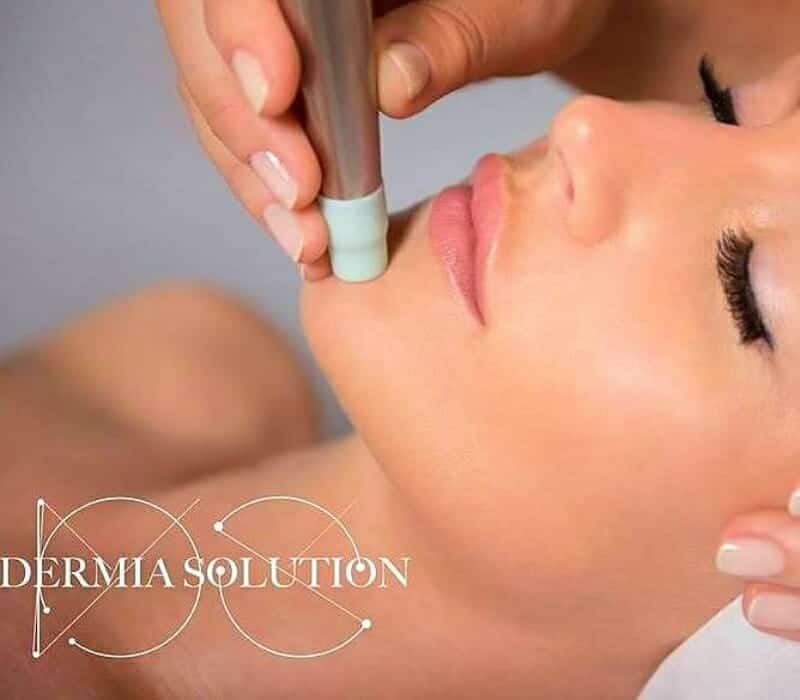 Dermia Solution Face Treatment Kauneushoitola BellaHelena Oulu